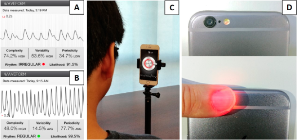 Figur 2. Eksempler på fotopletysmografi (PPG) (Cardiio Rhythm «app») fra pasient med atrieflimmer (A) og sinusrytme (B). Oppsett brukt for «ansiktsgjenkjenning» av atrieflimmer med PPG-signal (C). Samme teknologi kan og brukes for PPG-signal fra finger, ved hjelp av mobiltelefonens kamera (D). En rekke «apper» med slik funksjonalitet er allerede kommersielt tilgjengelige, men algoritmene som tolker signalene er svært ulike. Illustrasjon gjengis i henhold til Creative Commons Attribution Non-Commercial License, og i samråd med forfatterne [27].