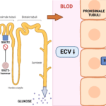 Figur 1: Virkning av SGLT2 - hemmere. Figuren viser effekten på proksimale nyretubuli med ekskresjon av glukose og natrium i urin. Tap av natrium fører til redusert ekstracellulært volum som resulterer i vasokonstriksjon i afferente arteriole, men hovedårsaken til vasokonstriksjonen er adenosinfrigjøring fra macula densa i distale nyretubuli grunnet økt ­natriumsensing, se tekst. Laget med BioRender.com.